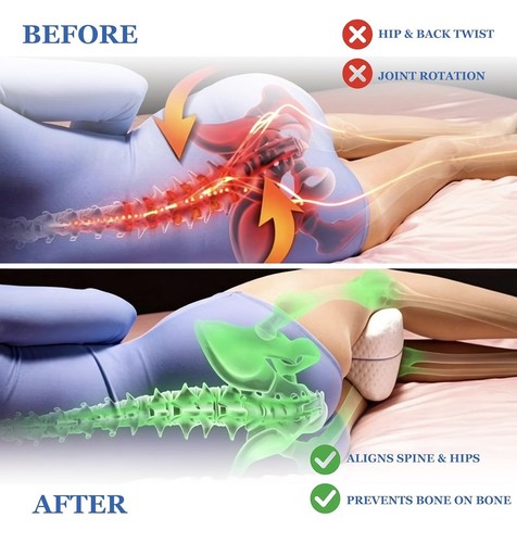 Orthopaedic knee pillow - knee, for